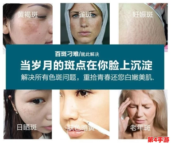 妈妈美白蚌埠，祛斑护肤产品哪个好？